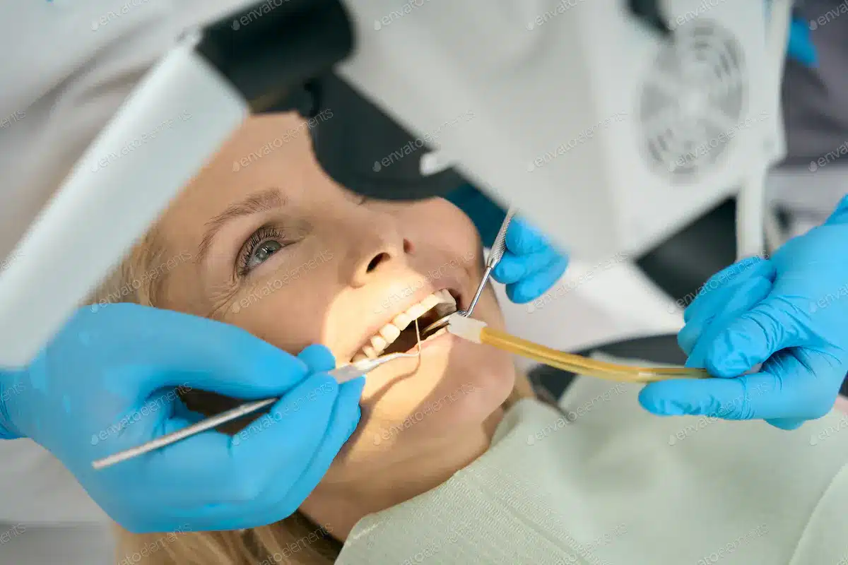 Dentist conducting a tooth colored filling procedure