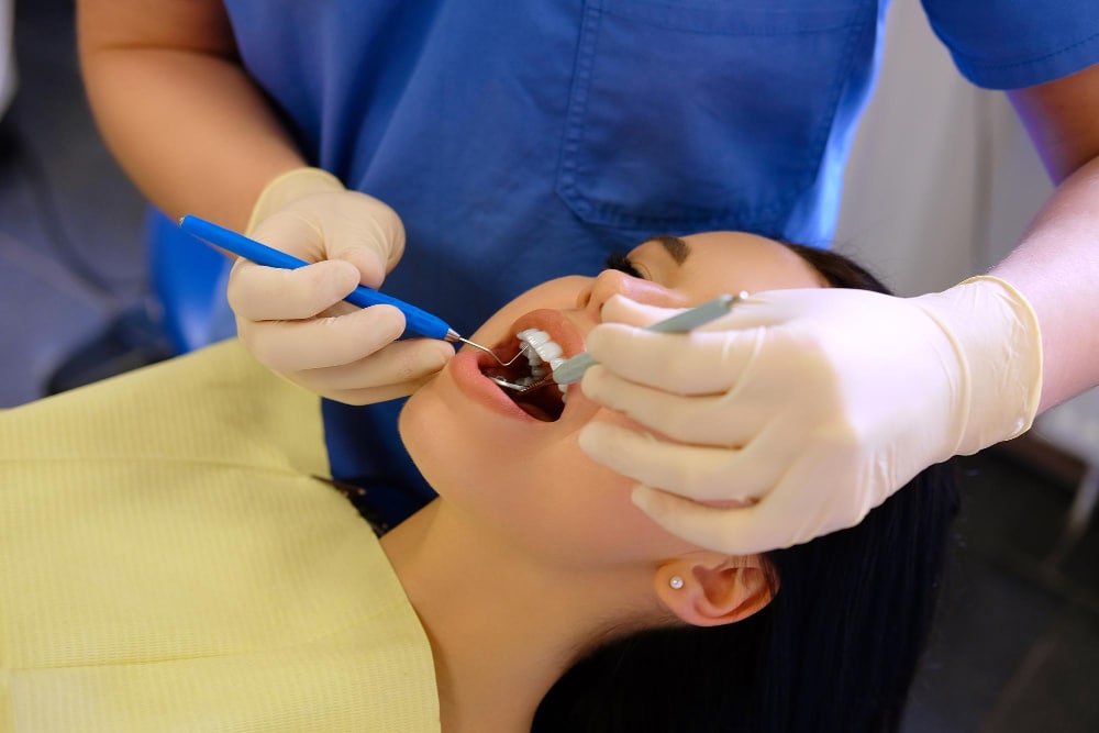 Dental Bonding at Canal Dentistry of Crawfordsville